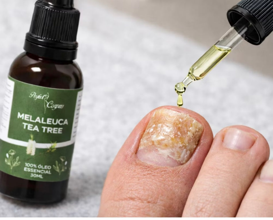 Óleo Essencial de Melaleuca Tea Tree 100% Puro 30ml